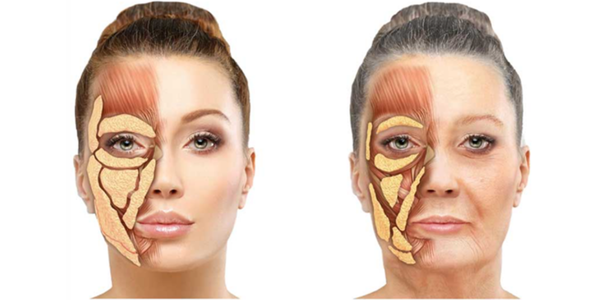Profhilo vs Profhilo Structura — What’s the Difference?